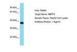 NBPF6 Rabbit anti-Human, Polyclonal, Novus Biologicals 0.1 mL | Buy Online | Novus Biologicals | Fisher Scientific